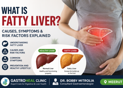 Fatty liver Doctor in Meerut