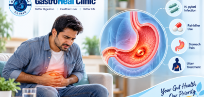 Peptic Ulcer Treatment in meerut